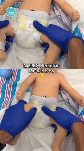 NCLEX Pediatric Must-Know 👧 Barlow & Ortolani tests for Developmental Dysplasia of the Hip (DDH) ✅ Barlow Test 🦴 ADduct the hip (knees together) ➕ Positive Barlow: palpable “clunk” as the femoral head slides posteriorly out of the acetabulum ✅ Ortolani Test 🦴 ABduct the hip (open the legs) ➕ Positive Ortolani: palpable “clunk” as the femoral head reduces back into the acetabulum A true ‘clunk’ felt/heard = positive sign for DDH ✅ Pediatrics Flashcards: https://nurseinthemaking.co/pediatricsfl