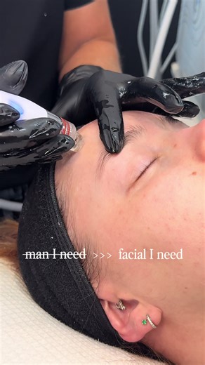 Overcome Commitment Issues with Our Facial Treatments