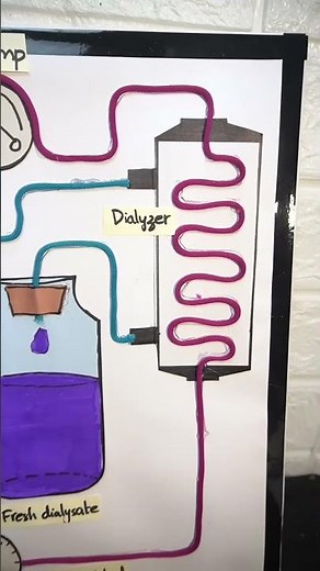 Dialysis 2D Model Project for School | How Dialysis Works | 2D Model of Kidney Dialysis System | DIY