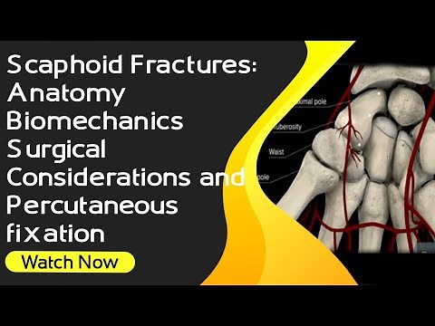 Scaphoid Fractures: Anatomy, Biomechanics, Surgical Considerations and Percutaneous fixation