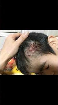 【ある日突然失明していた息子】自閉傾向の強いダウン症児の自傷に悩む母 supported by NSP #NSP #共生社会 #964万7千分の一