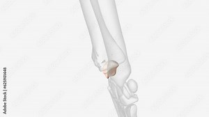 The scaphoid bone is one of the carpal bones on the thumb side of the wrist, just above the radius