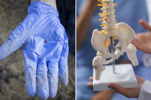 Prostate cancer tumors have more than twice as much of this pollutant as healthy tissue: study