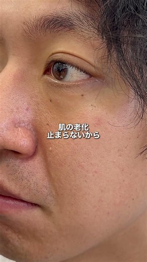 モテたいなら絶対これ！ 清潔感が上がる毛穴美容液🔥 #メンズ美容 #毛穴 #自分磨き #美容男子 #黒ずみ pr