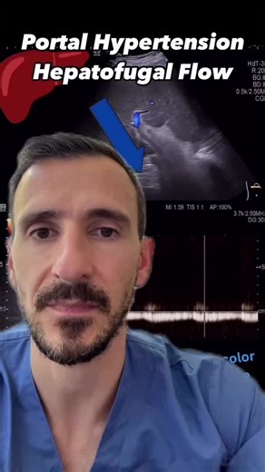 Understanding Portal Hypertension Through Ultrasound Imaging