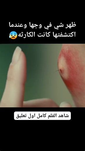 My cima on Instagram‎: "رابط تحميل تطبيق المشاهدة مجانا في اول تعليق 👇❤️👇❤️👇"‎