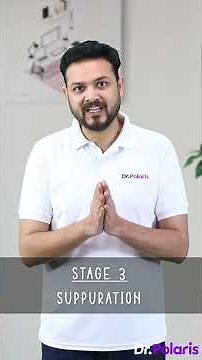 Acute Suppurative Otitis Media - ENT