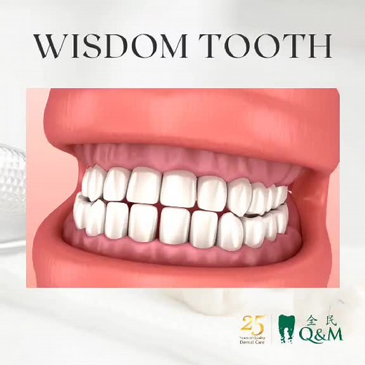Understanding Why Wisdom Teeth Hurt