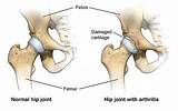 What Type Of Doctor For Hip Pain Images