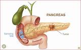 Top Pancreatic Cancer Doctors