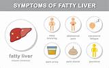 What Type Of Doctor Should I See For Liver Problems Photos