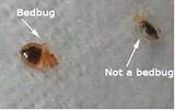 Photos of Bed Bug Treatment On Body