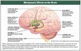 Pictures of What Does Marijuana Do To Your Body And Brain