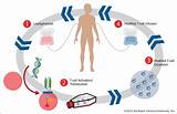 Modified T Cells Cancer Treatment Images