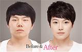 The Best Korean Plastic Surgery Clinic Pictures