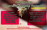 Home Remedies Wasp Bite Images
