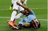Photos of Injuries In Soccer
