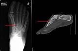 Ortho Fracture Clinic Images