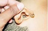 Pictures of How Do Doctors Clean Ears