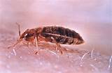 Exterminator To Get Rid Of Bed Bugs
