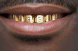 Gold Teeth Dentures Pictures