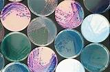 Culture Plates Microbiology Images