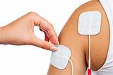 Transcutaneous Electrical Nerve Stimulation Pictures