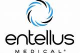 Pictures of Entellus Medical News