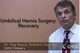 Umbilical Hernia Surgery Recovery Images