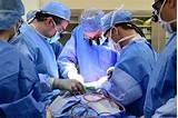Cleveland Clinic Transplant Surgeons Photos