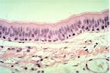 Pictures of Where Can Epithelial Tissue Be Found
