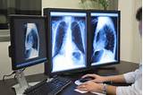 Photos of Online Colleges For Xray Tech