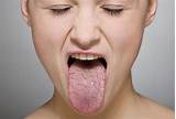 Medications That Cause Dry Mouth Images