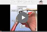 Physical Therapy For Rotator Cuff Surgery Recovery