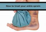 Photos of Sprained Ankle Recovery Tips