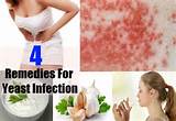 In Home Remedies For Yeast Infection Photos