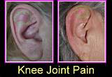 Knee Joint Therapy