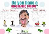 Raw Tongue Home Remedies Pictures