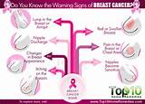 Can Men Get Breast Cancer Photos