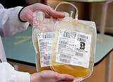 Pictures of How Much Money Can You Make Donating Blood Plasma