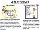 What Type Of Doctor Is A Kidney Specialist Pictures