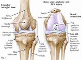 Soccer Knee Injuries Treatment