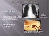 Images of Welding Lung Cancer