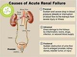 Photos of What Does A Renal Doctor Do