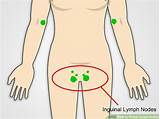 What Is A Lymph Node Doctor Called Photos