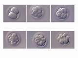 Pictures of Ivf Embryo Transfer