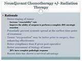 Chemotherapy And Radiation Therapy For Esophageal Cancer