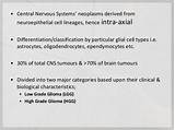 Photos of Astrocytoma Treatment Options