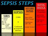 Pictures of Septic Shock Recovery Time