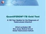 Quantiferon Tb Gold Blood Test Positive Images